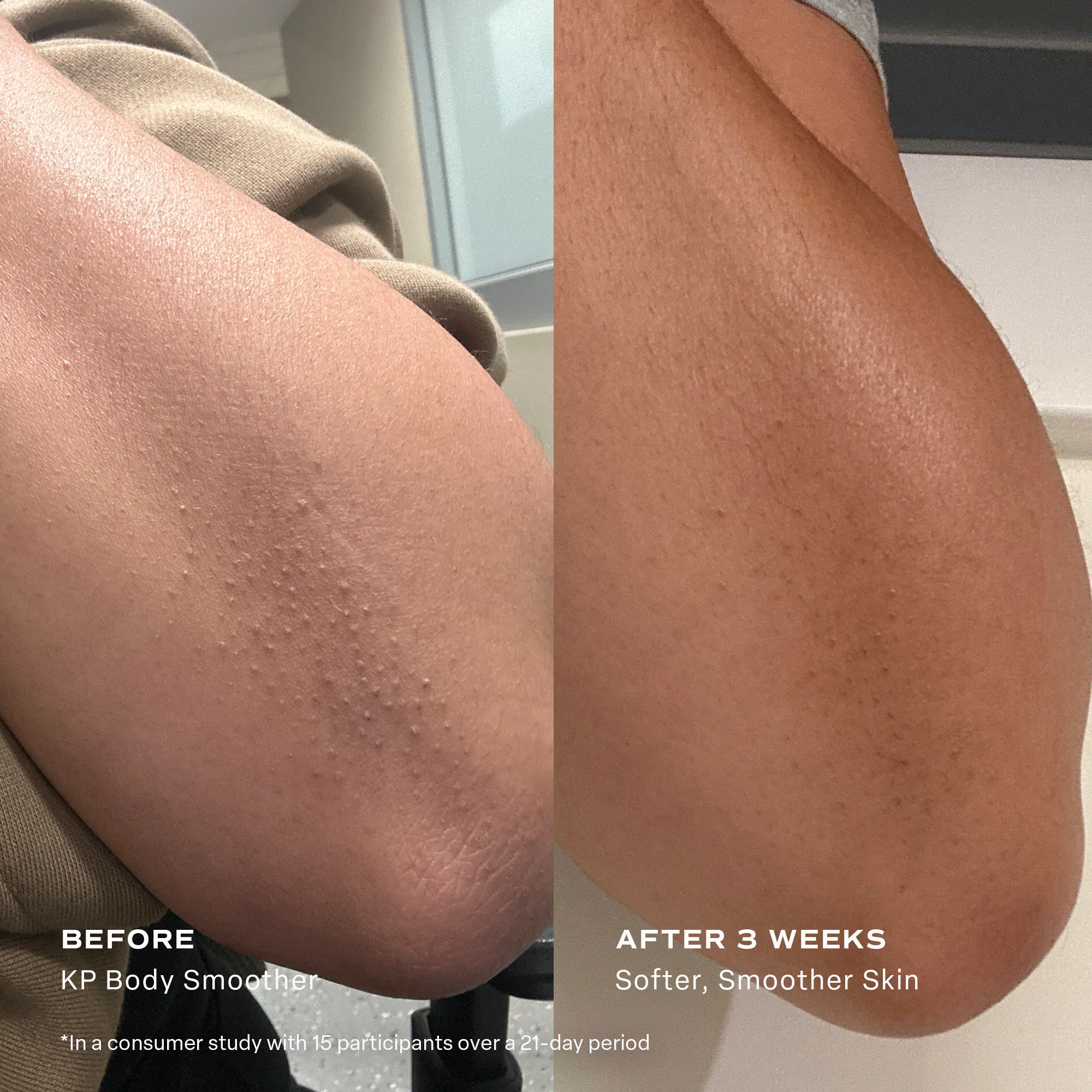 KP Body Smoother Exfoliating Milk - Image 10