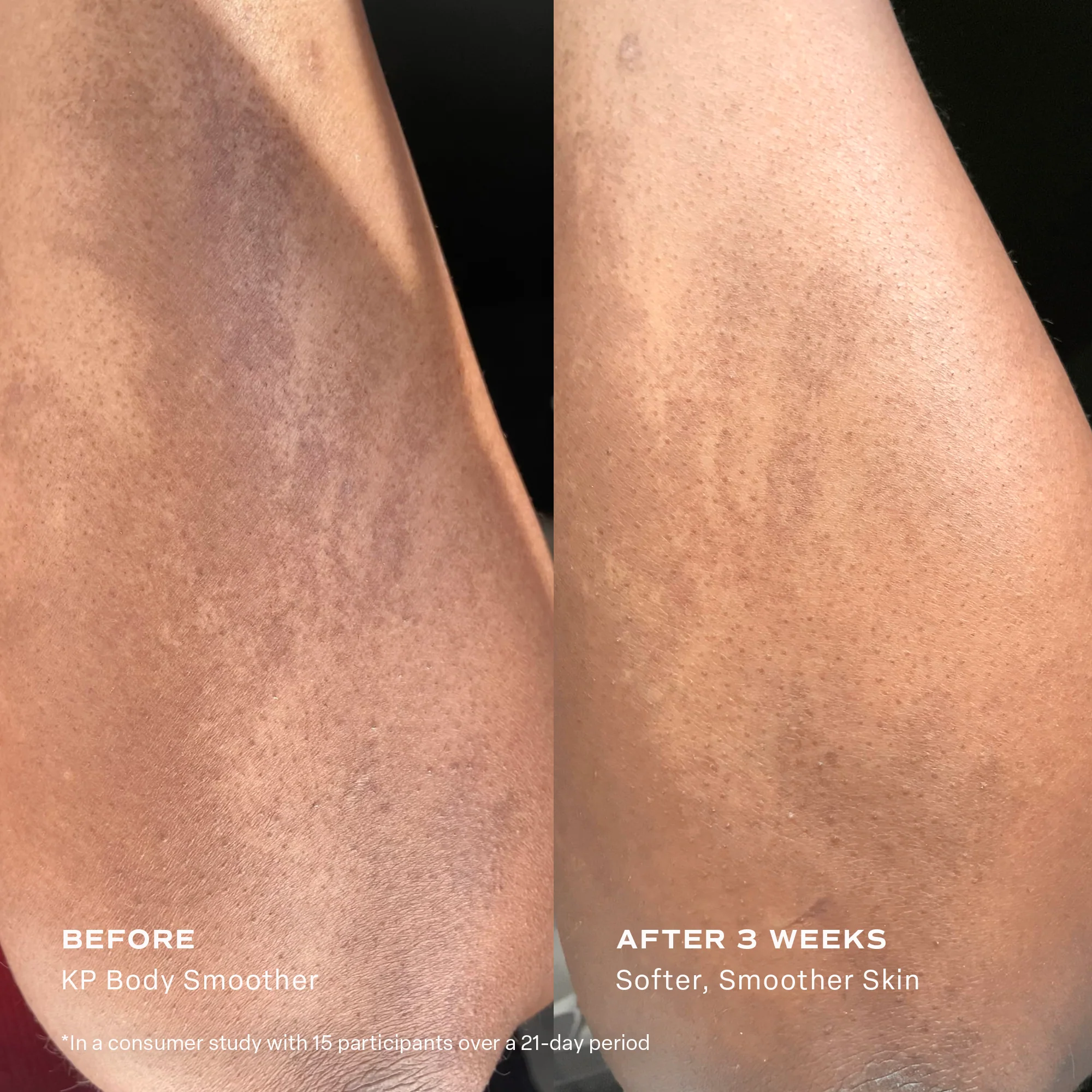 KP Body Smoother Exfoliating Milk - Image 8